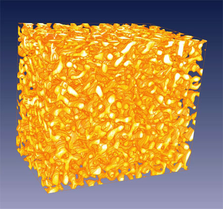 Nanoporous gold